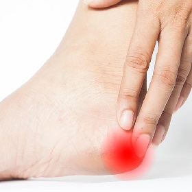 Пяточная шпора