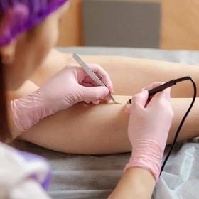 Что такое пилинг лица