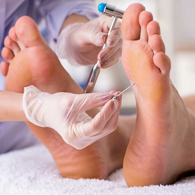 Медицинский педикюр - уход за кожей стоп