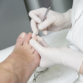 Медицинский педикюр - процедура по уходу за ногтями