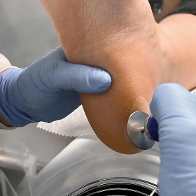 Обработка стоп при смарт педикюре