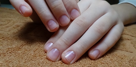 Ногти на руках