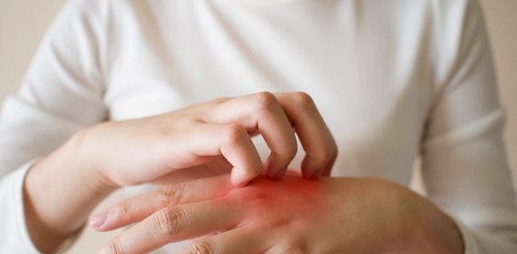 Сыпь на руках